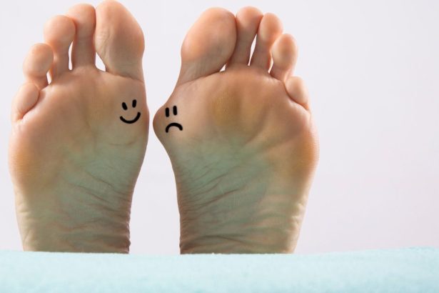 Unveiling the Truth: Do Shoes Really Cause Bunions?