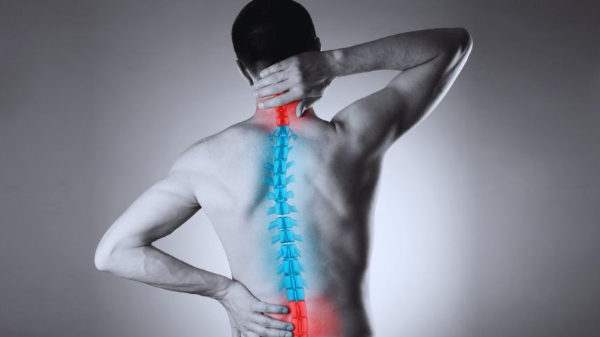 Diagnosis to Relief: Ultimate Guide to Managing Scoliosis Pain
