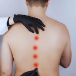 Swayback to Strong: How Correct Lordosis with Targeted Workouts